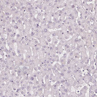 Anti-FBN1 Antibody