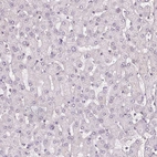 Immunohistochemical staining of human liver shows no positivity in hepatocytes as expected.