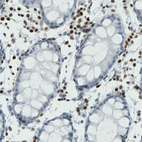 Anti-RUNX2 Antibody