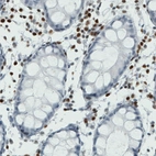 Immunohistochemical staining of human rectum shows nuclear positivty in lymphoid cells.