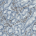 Immunohistochemical staining of human small intestine shows nuclear immunoreactivity in lymphoid cells.