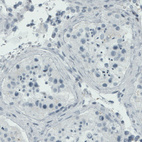 Anti-RUNX2 Antibody