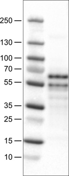 Lane 1: Marker [kDa]_br/_Lane 2: Human cell line U-251 MG