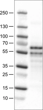 Lane 1: Marker [kDa]_br/_Lane 2: Human cell line U-251 MG