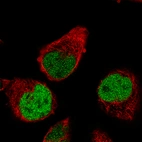Immunofluorescence staining of RH-30 cells using the Anti-RUNX2 monoclonal antibody, showing specific staining in the nucleoplasm in green. Microtubule- and nuclear probes are visualized in red and blue, respectively (where available).
