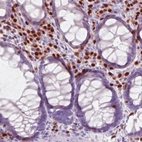 Immunohistochemical staining of human colon shows strong nuclear immunoreactivity in the lymphoid cells.