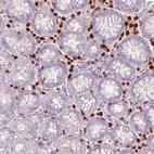 Immunohistochemical staining of human stomach shows strong nuclear immunoreactivity in the lymphoid cells.