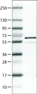 Lane 1: Marker [kDa]_br/_Lane 2: Human cell line U-251 MG