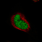 Immunofluorescence staining of RH-30 cells using the Anti-RUNX2 monoclonal antibody, showing specific staining in the nucleoplasm in green. Microtubule- and nuclear probes are visualized in red and blue, respectively (where available).