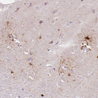 Anti-FABP7 Antibody