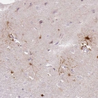 Immunohistochemical staining of human cerebral cortex shows moderate to strong cytoplasmic positivity in glial cells.