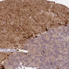 Immunohistochemical staining of human cerebral cortex shows strong cytoplasmic positivity in a subset of cells in molecular layer.