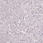 Immunohistochemical staining of human liver shows no positivity in hepatocytes as expected.