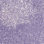 Immunohistochemical staining of human tonsil shows no positivity in non-germinal center cells as expected.