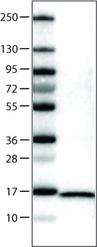 Lane 1: Marker [kDa] _br/_ Lane 2: Human cell line U-251 MG
