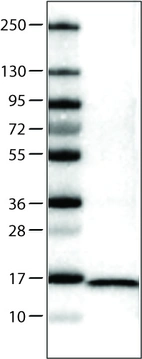 Lane 1: Marker [kDa] _br/_ Lane 2: Human cell line U-251 MG