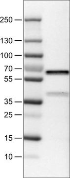 Lane 1: Marker [kDa]_br/_Lane 2: Human breast cancer cell line MCF7