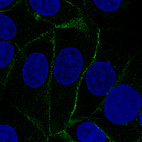 Immunofluorescence staining of MCF7 cells using the Anti-VANGL1 monoclonal antibody, showing specific staining of plasma membrane in green. Microtubule- and nuclear probes are visualized in red and blue, respectively (where available).