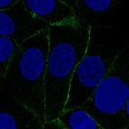 Immunofluorescence staining of MCF7 cells using the Anti-VANGL1 monoclonal antibody, showing specific staining of plasma membrane in green. Microtubule- and nuclear probes are visualized in red and blue, respectively (where available).