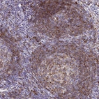 Immunohistochemical staining of human lymph node shows moderate to strong cytoplasmic positivity in lymphoid cells.