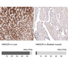 Anti-HMGCR Antibody