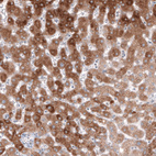 Anti-HMGCR Antibody