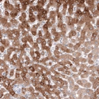 Immunohistochemical staining of human liver shows moderate cytoplasmic positivity in hepatocytes.
