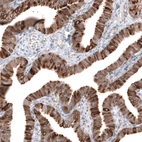 Immunohistochemical staining of human fallopian tube shows moderate to strong cytoplasmic positivity in glandular cells.