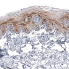 Immunohistochemical staining of human uterine cervix shows moderate cytoplasmic positivity in squamous epithelial cells.