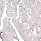 Immunohistochemical staining of human skeletal muscle shows no positivity in myocytes as expected.