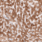 Anti-HMGCR Antibody