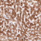 Immunohistochemical staining of human liver shows moderate cytoplasmic positivity in hepatocytes.