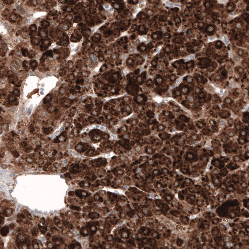 Mouse Monoclonal AntiHMGCR Antibody Buy for research Highly specific, rigorously validated