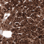 Anti-HMGCR Antibody