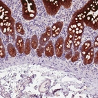 Immunohistochemical staining of human duodenum shows strong membranous and cytoplasmic positivity in glandular cells.