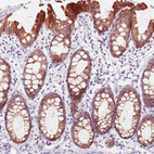 Anti-ACSL5 Antibody