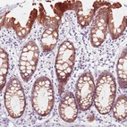 Immunohistochemical staining of human colon shows strong membranous positivity in glandular cells.