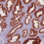 Anti-ACSL5 Antibody