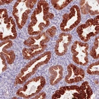 Immunohistochemical staining of human endometrium shows strong membranous and cytoplasmic positivity in glandular cells.