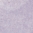 Anti-ACSL5 Antibody