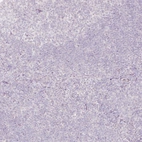Immunohistochemical staining of human tonsil shows no positivity in non-germinal center cells as expected.