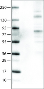 Anti-ACSL5 Antibody