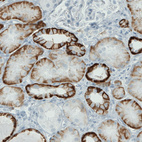 Anti-CA12 Antibody