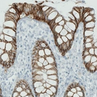 Immunohistochemical staining of human rectum shows strong membranous positivity in glandular epithelial cells.