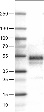 Lane 1: Marker [kDa]_br/_Lane 2: Human tonsil tissue lysate