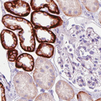 Anti-CA12 Antibody