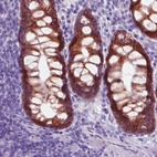 Immunohistochemical staining of human colon shows strong cytoplasmic and membrane positivity in glandular cells.