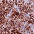 Immunohistochemical staining of human pancreas shows strong membranous and moderate cytopalsmic positivity in the exocrine cells.