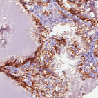 Anti-CA12 Antibody
