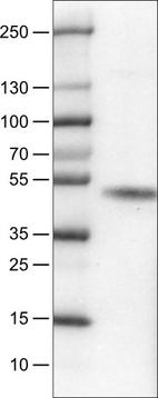 Lane 1: Marker [kDa]_br/_Lane 2: Human RT-4 cell line